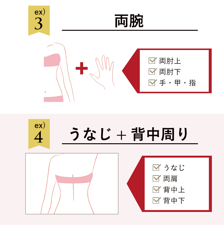 打ち放題30分の施術でこれくらいの範囲が照射可能です。